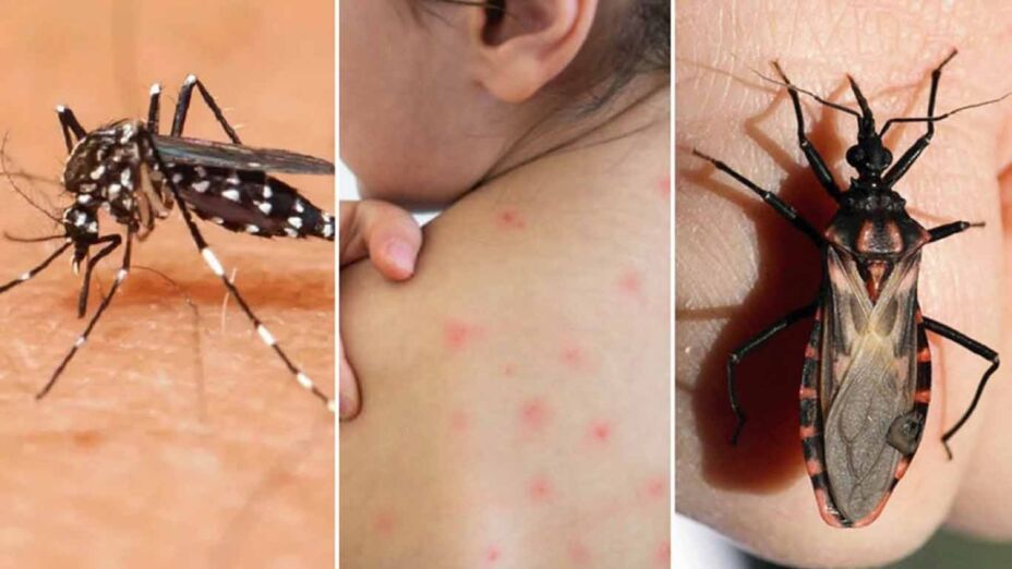 Que Es Chagas Sintomas Que Es Chagas Sintomas