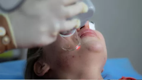 /estilo-de/consecuencias-si-tratas-cicatrices-laser-voz-expertos-pb-notas