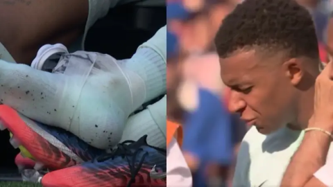 Mbappe lesión