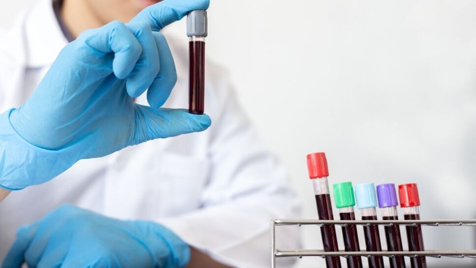 cáncer, análisis de sangre b.jpg