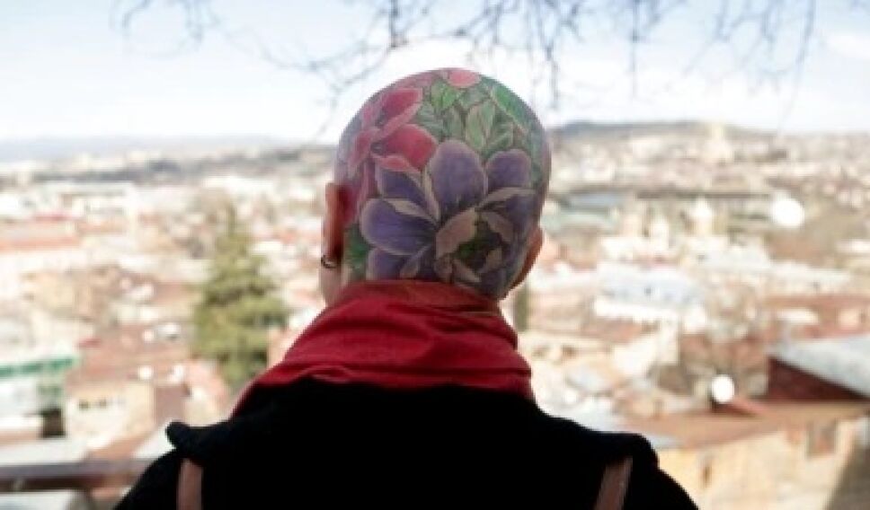 Convierte su cráneo en lienzo y con tatuaje cubre su alopecia.jpg