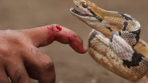 Niña de 8 años sufre mordedura de serpiente en Quintana Roo y es hospitalizada de emergencia