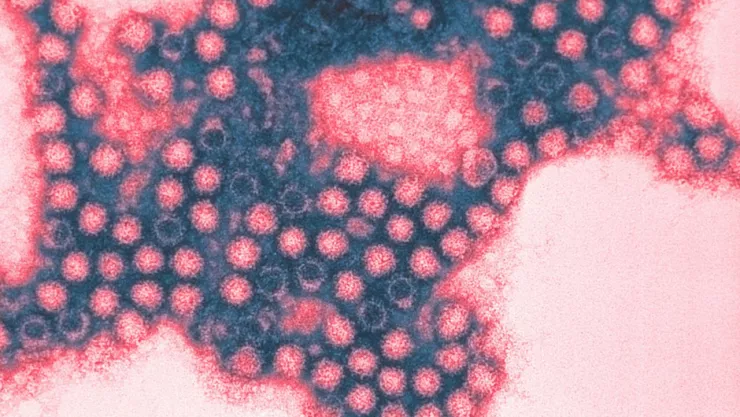 Detectan extraño virus en el Océano Pacífico