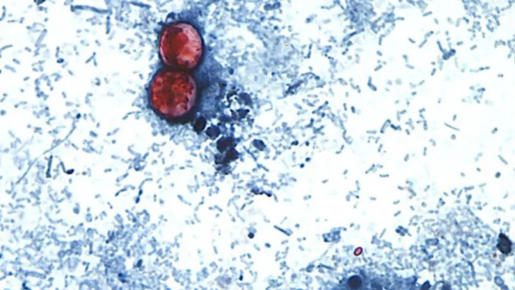 Cyclospora en México: confirman 33 casos y continúan investigaciones en Guanajuato y Quintana Roo