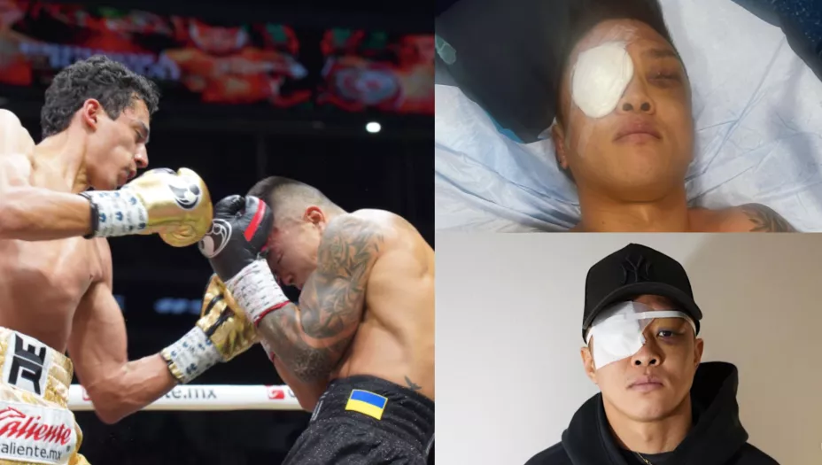 divino espinoza arnold khegai lesion ojo