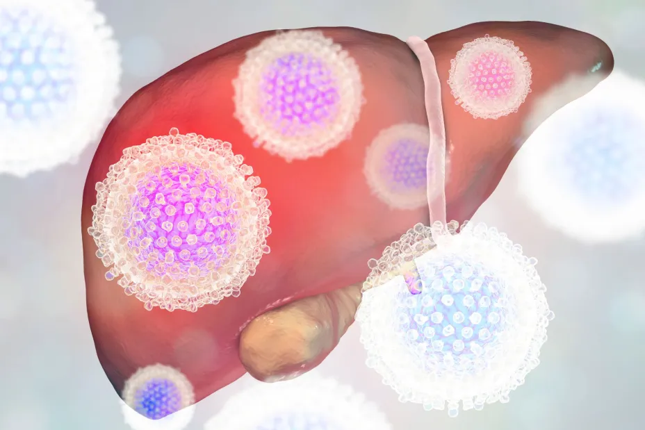 Hepatitis C -Kateryna Kon.jpg