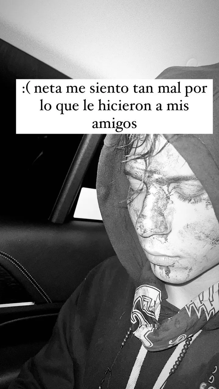 Amigo de Yeri Mua todo golpeado.
