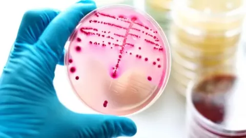Una bacteria carnívora en Japón está encendiendo las alertas