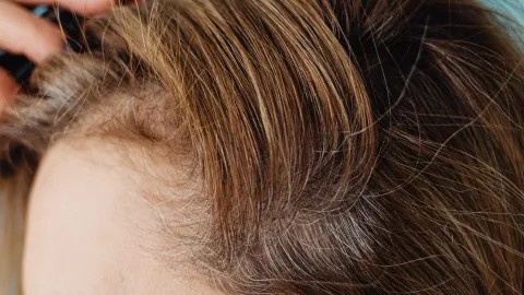 Así puedes ocultar las canas con tónicos de ingredientes naturales