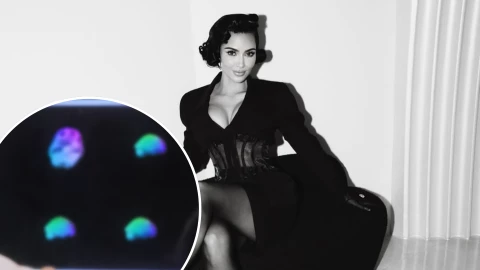 Doctor le revela a Kim Kardashian que tiene agujeros