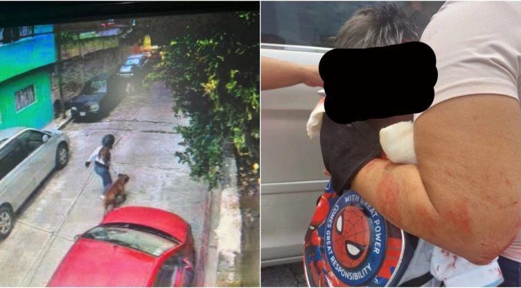 Perro pitbull ataca a niño en Jiutepec Morelos