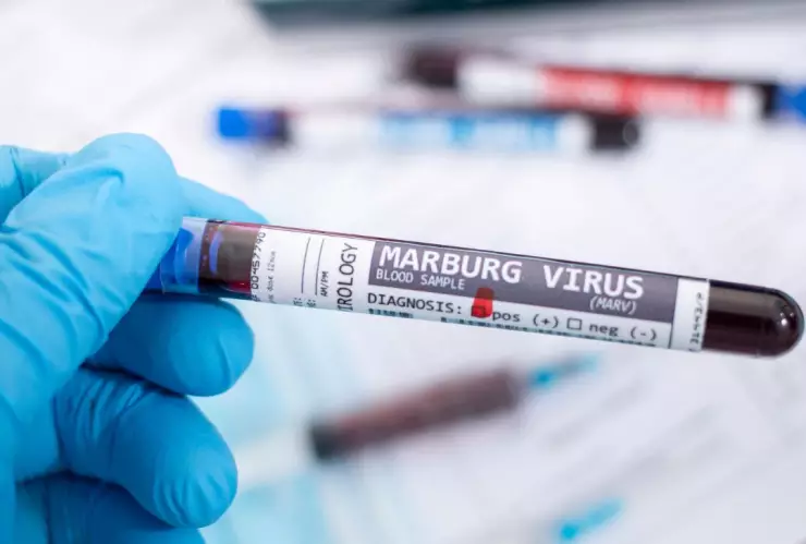 Sintomas del virus de Marburgo 2024