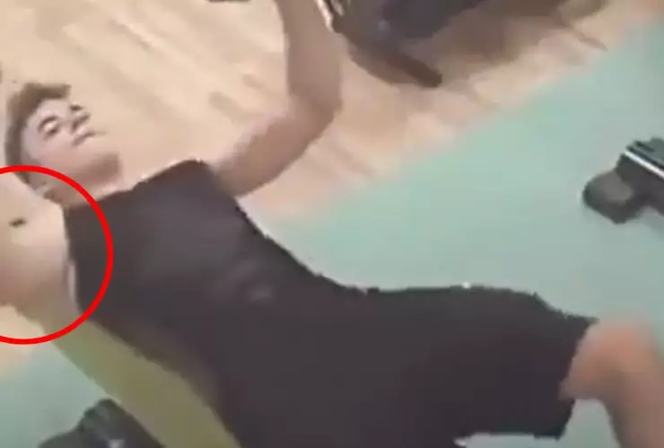 Joven se rompe el hombro en un gimnasio
