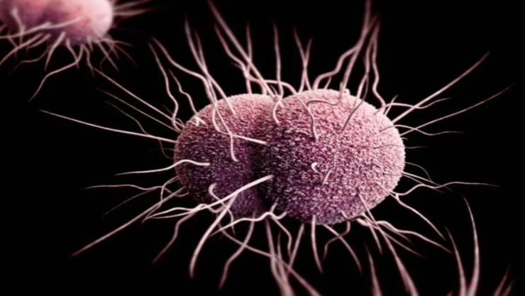 La resistencia de la bacteria Neisseria gonorrhoeae es un problema global