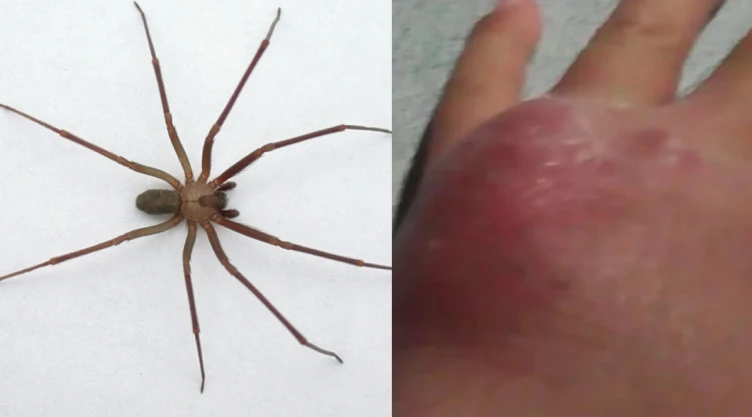 Temporada de araña violinista 2025: ¿Cuándo es y qué hacer ante una mordedura?