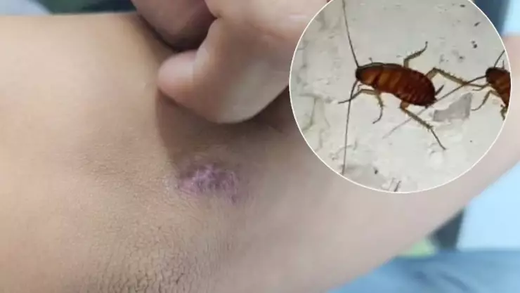 Aumentan casos de mordeduras de cucarachas en Yucatán por las altas temperaturas