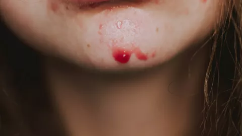 Vinculan a proceso a hombre por violencia familiar en Yucatán: Golpeó a su pareja sentimental