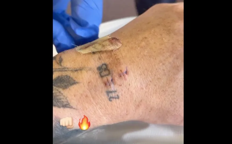 Canelo Álvarez operacion mano izquierda