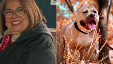 Mujer es atacada por dos perros pitbull al intentar darles de comer