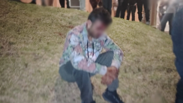 Presunto exhibicionista golpeado y ensangrentado en un parque en Puebla