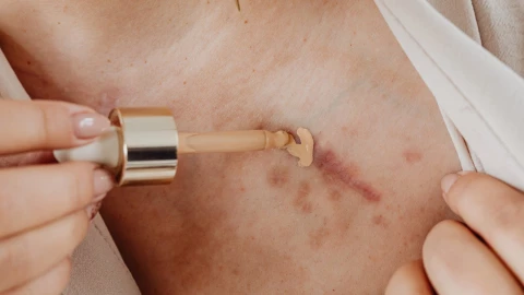 Mujer cubriéndose con corrector las manchas rojas de su cuerpo.