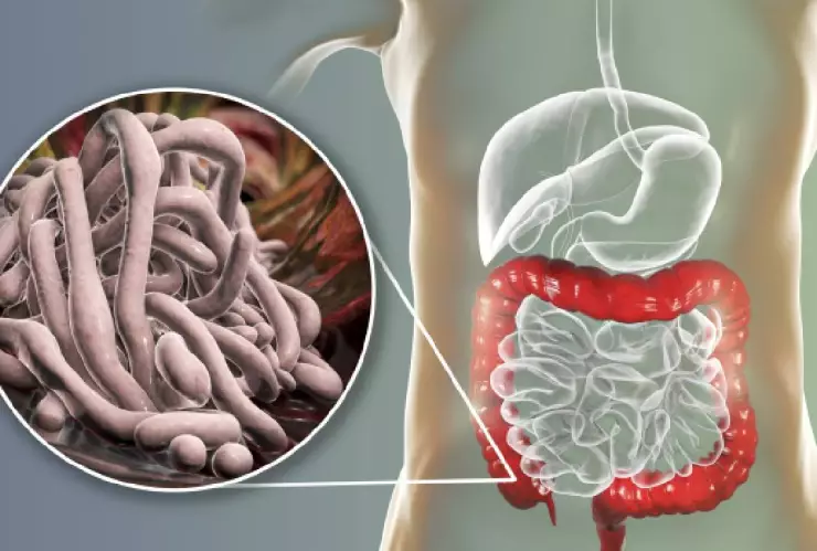 Cuándo es necesario desparasitarse y qué pasa si no lo hago
