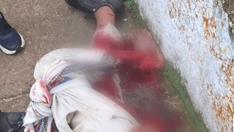 Ladrón pierna destrozada