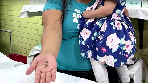 En Perú, bebé de 10 meses de traga un crucifijo por accidente