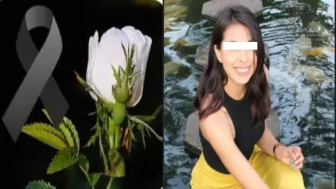 Karla “N” fallecio tras cirugía estética en la nariz
