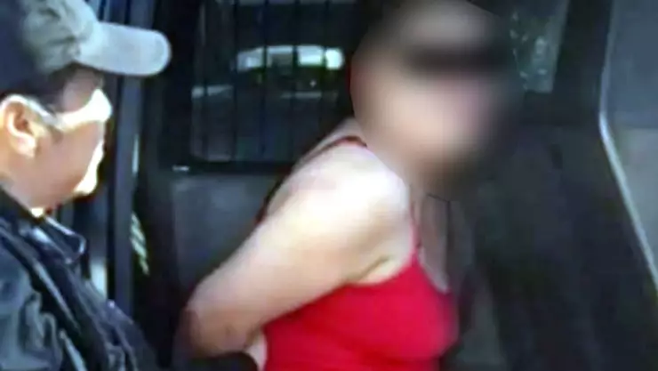 quemaduras en las manos de su hija de 5 años