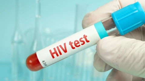 Casos de VIH aumentan en Yucatán y los hombres encabezan la lista