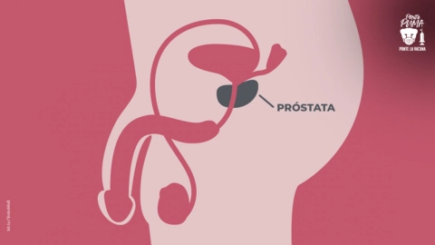 Cáncer-de-próstata (1).jpg