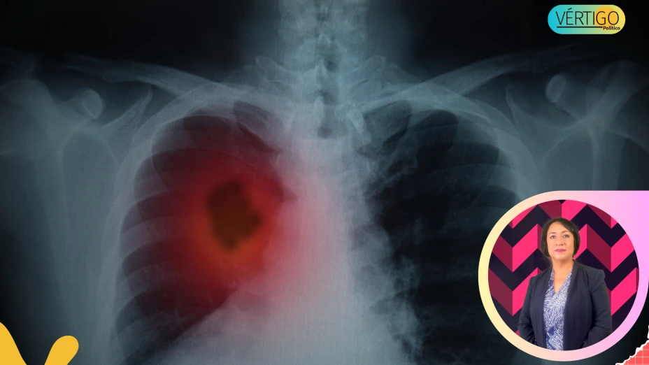 Cáncer de pulmón