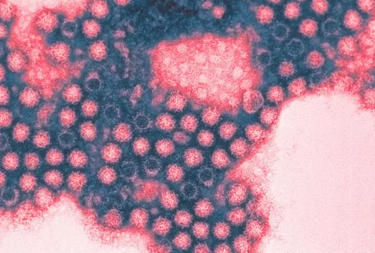 Detectan extraño virus en el Océano Pacífico