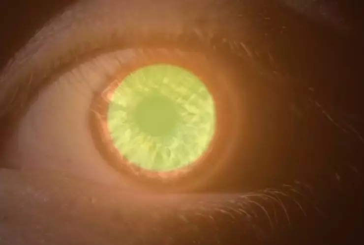 ¿Cómo saber si el eclipse solar 2024 daño mi vista_.jpg