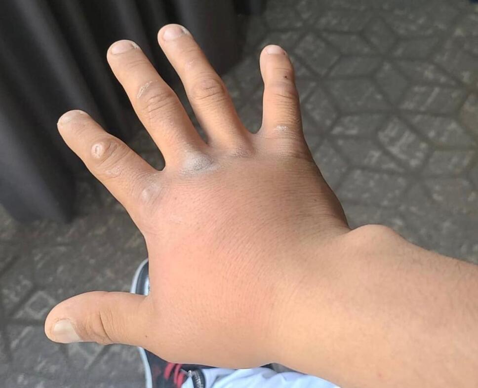 Mano de Martínez.jpeg
