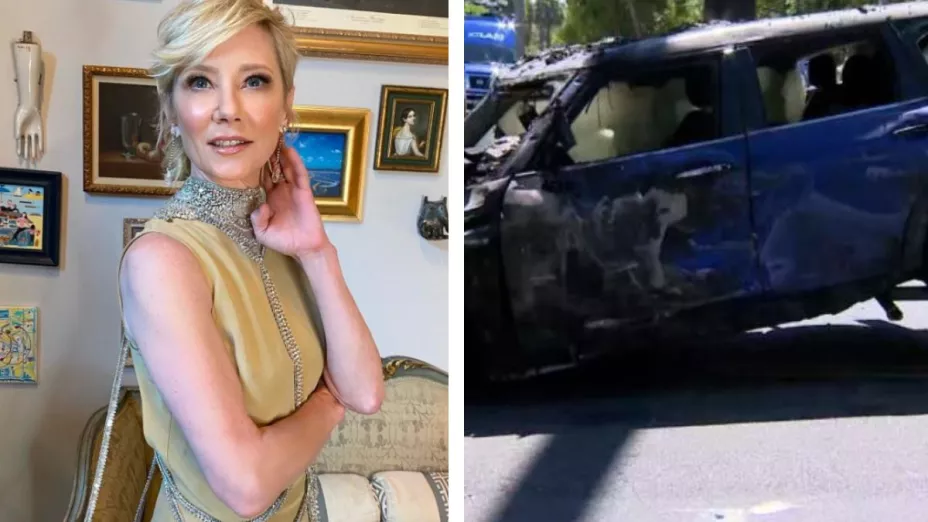 La actriz Anne Heche sufre accidente en su auto que conducía por Los Ángeles, California.