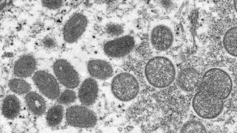 Pandemia de la viruela del mono terminó, declara OMS