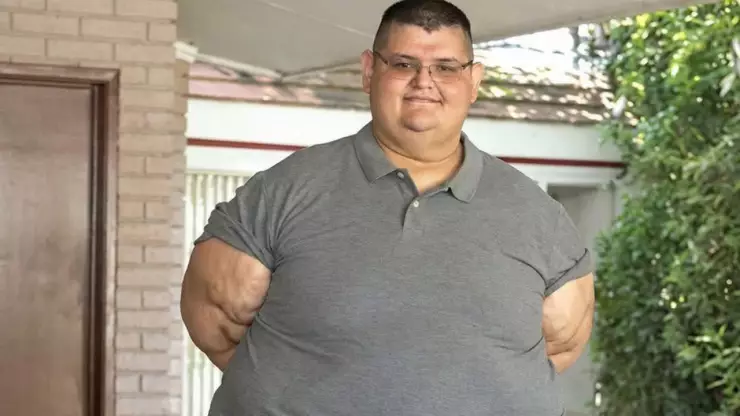 muere hombre más obeso del mundo en Aguascalientes