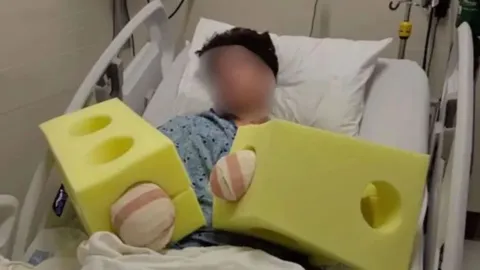 ¡IMÁGENES SENSIBLES! Joven PIERDE LAS MANOS tras brutal accidente con fuegos artificiales
