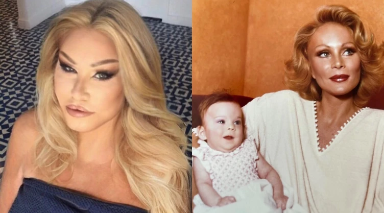 ¿De qué murió la “mujer gato” Jocelyn Wildenstein?