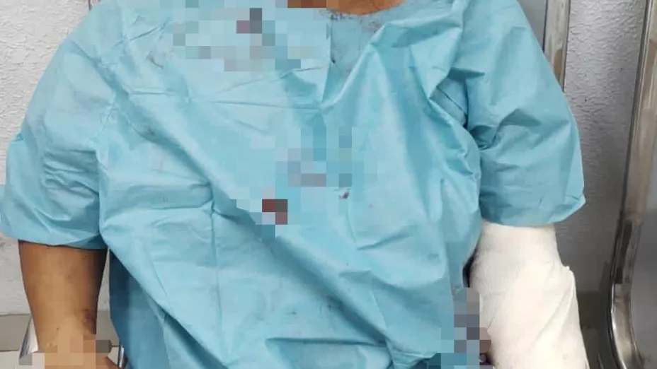 mujer apuñalada en uman