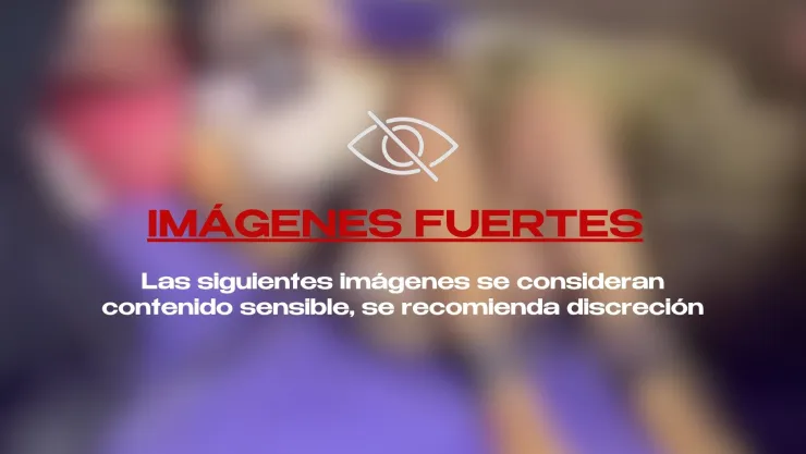 IMÁGENES FUERTES | Encadenada a una cama, así encontraron a una mujer reportada como desaparecida