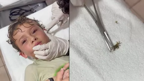 Niño va al doctor por un cangrejo en la oreja y se hace viral | VIDEO