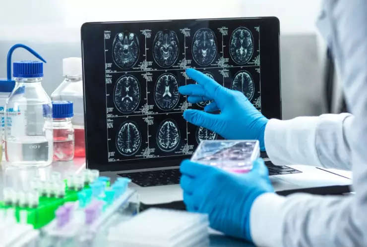 Nuevo fármaco para tratar el Alzheimer