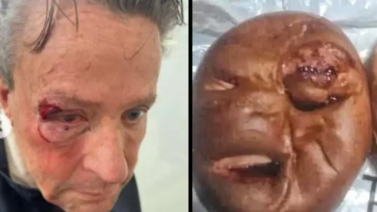 Sacan pan inspirado en rostro golpeado de Alfredo Ademe