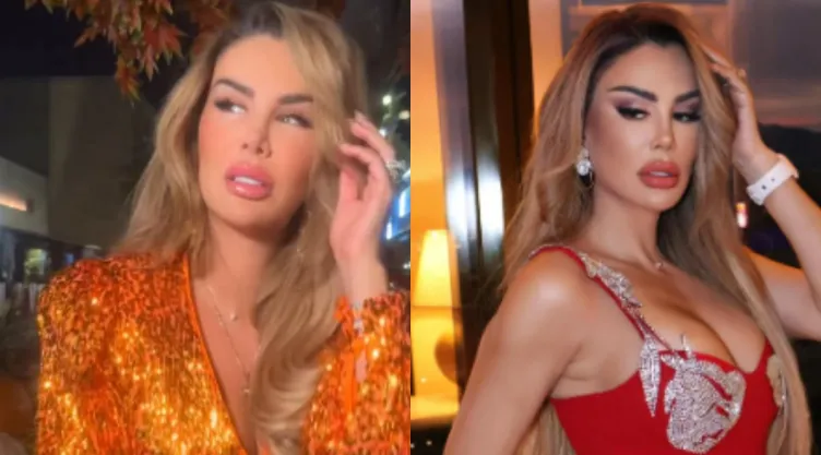 /famosos/ninel-conde-cambio-color-ojos-cuantos-millones-costo-operacion-pb-notas