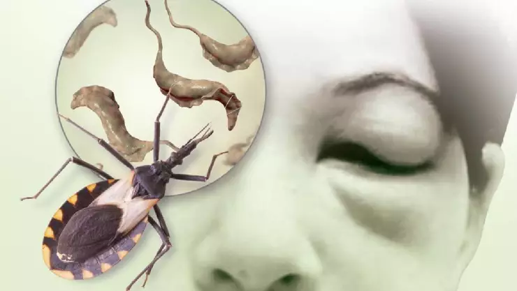 Enfermedad de Chagas