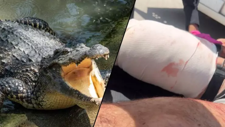 VIDEO: Hombre sufre ataque de cocodrilo mientras pescaba en Tamaulipas