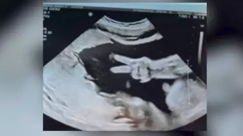 Bebe saluda en ecografia.